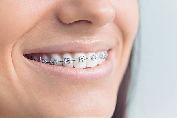 Best Veneers and Lumineers  in Richmond, MI